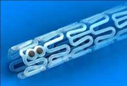 Mercado mundial de stents bioabsorbibles