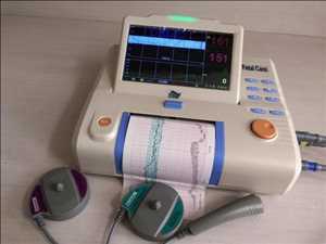 Cardiotocógrafo (CTG)
