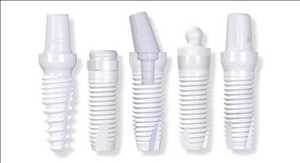 Implante dental de zirconia