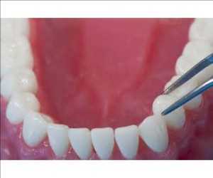 Implantes dentales de circonio