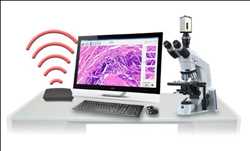 Mercado global de servicios de telepatología