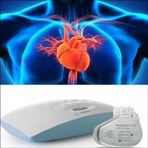 Global-Cardiac-Rhythm-Management-Device-Market