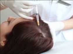 Medicamentos para la caída del cabello