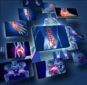 Global-Medical-Imaging-Market