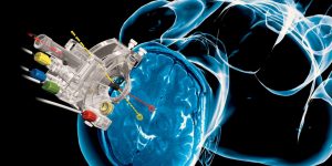 Mercado global de dispositivos de neurocirugía mínimamente invasivos