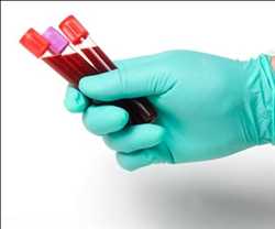 Recogida de sangre