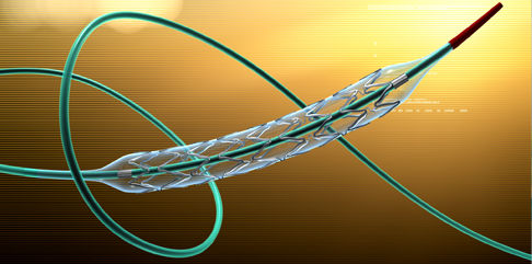 Dispositivos neurovasculares