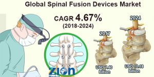 Mercado de dispositivos de fusión espinal