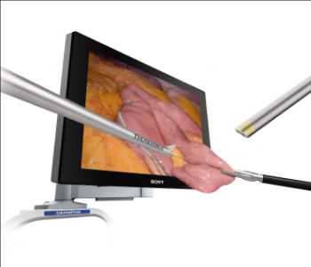 Global Plataforma de imágenes médicas y quirúrgicas 3D Pronóstico del mercado