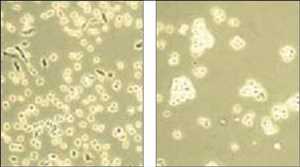 Cell Disassociation Tendencias de crecimiento del mercado