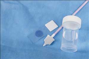 Cervical Cancer Diagnostic Test Mercado Demanda-Oferta