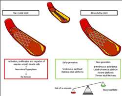 Stents liberadores de fármacos