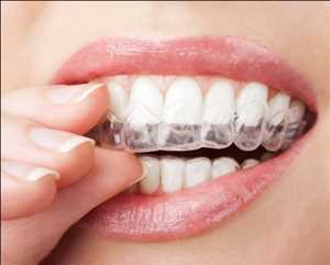 Invisible Orthodontics Pronóstico del mercado