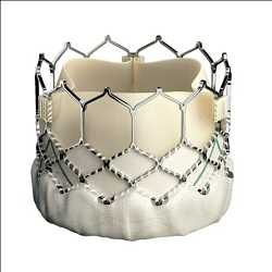 Válvulas cardíacas transcatéter