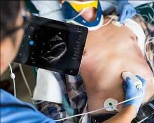 Tendencia global del mercado de dispositivos de gestión de urolitiasis