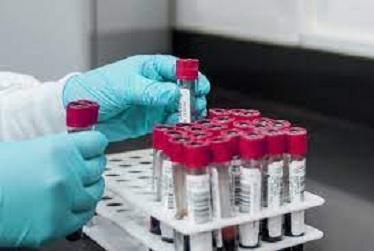 Global Muestras humanas de biobancos Cuota de mercado