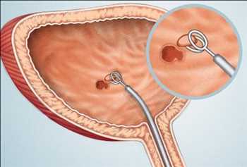 Global Diagnóstico de cáncer de vejiga Jugadores líderes del mercado