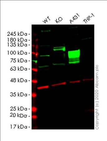 Global Productos lisados Pronóstico del mercado