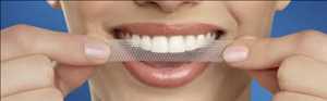 Global-Teeth-Whitening-Strips-Market