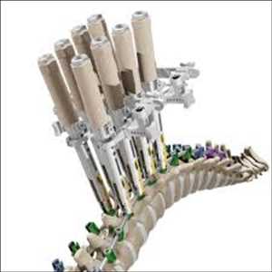 Global Tornillo pedicular Datos pasados del mercado