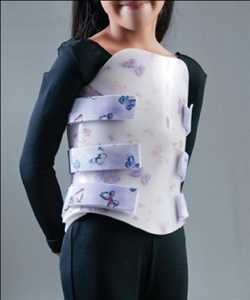 Manejo de la escoliosis Mercado