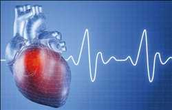 Nombre de la imágen