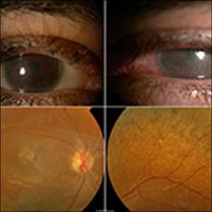 Nombre de la imágen