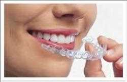 Global Brackets dentales Mercado