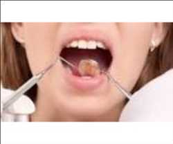 Mercado mundial de empastes dentales