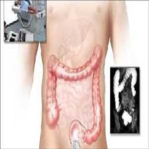 Electrocardiógrafo gastrointestinal