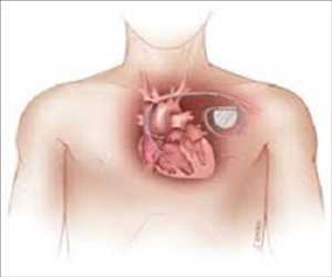 Global-Implantable-Cardiac-Pacemaker-Market