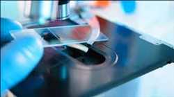 Diagnóstico de enfermedades infecciosas