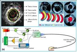 Global Catéter de ultrasonido intravascular (Ivus) Mercado