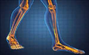 Global-Lower-Extremities-Market