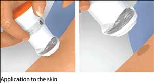 Global Microneedle Market Demand