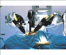 Global Surgical Robots Revenue