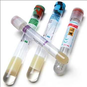 Global Equipo de recolección de sangre Hechos del mercado