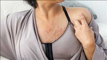 Global Lumpectomía Análisis de mercado