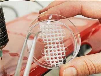 Global Material de implantación médico Análisis de mercado