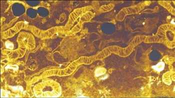 Global Inhibidores de mTOR Cuota de mercado