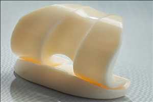 Espaciadores temporales de rodilla Pronóstico del mercado