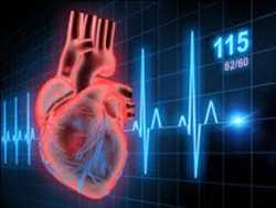 Diagnóstico de enfermedades cardiovasculares