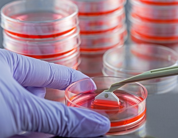 Global Recolección de células Tendencia del mercado