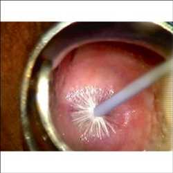 Global-Colposcopy-Market