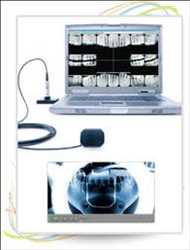 Global-Dental-Digital-X-Ray-Market