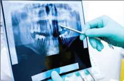 Global-Dental-Imaging-Market