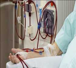 Global-Dialysis-Equipment-Market