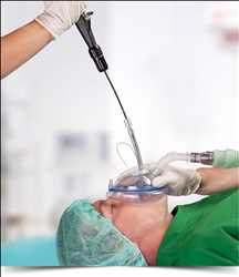 Global-Endoscopy-Market