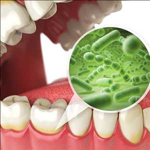 Global Tratamiento de halitosis Datos históricos del mercado
