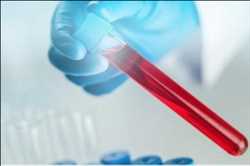 Global-Healthcare-Biomarkers-Market